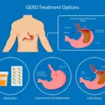 The Impact of Reflux Disease on Daily Life