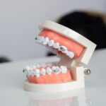 Understanding the Different Types of Orthodontic Treatments