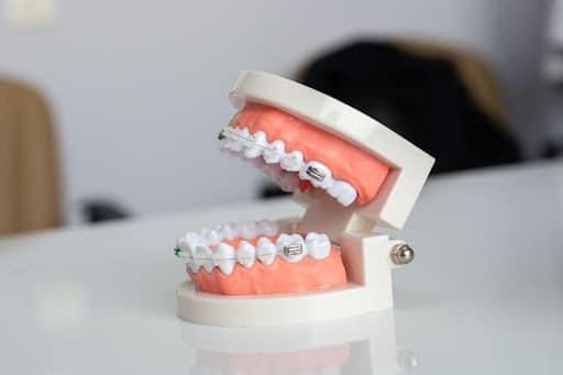 Understanding the Different Types of Orthodontic Treatments