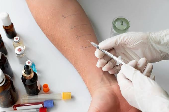 Understanding the Role of Allergy Testing in Personal Health