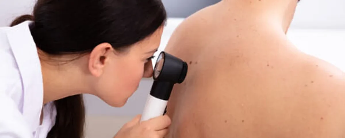 Benefits of Regular Skin Checks in Dermatology