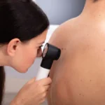 Benefits of Regular Skin Checks in Dermatology