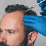 Combining PRP Therapy With Other Treatments for Optimal Results
