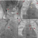 How Cardiology Plays a Role in Managing Chronic Conditions