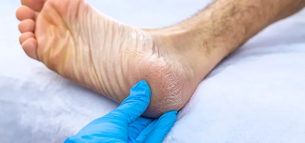 Understanding When to See a Podiatrist for Foot Pain