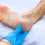 Understanding When to See a Podiatrist for Foot Pain