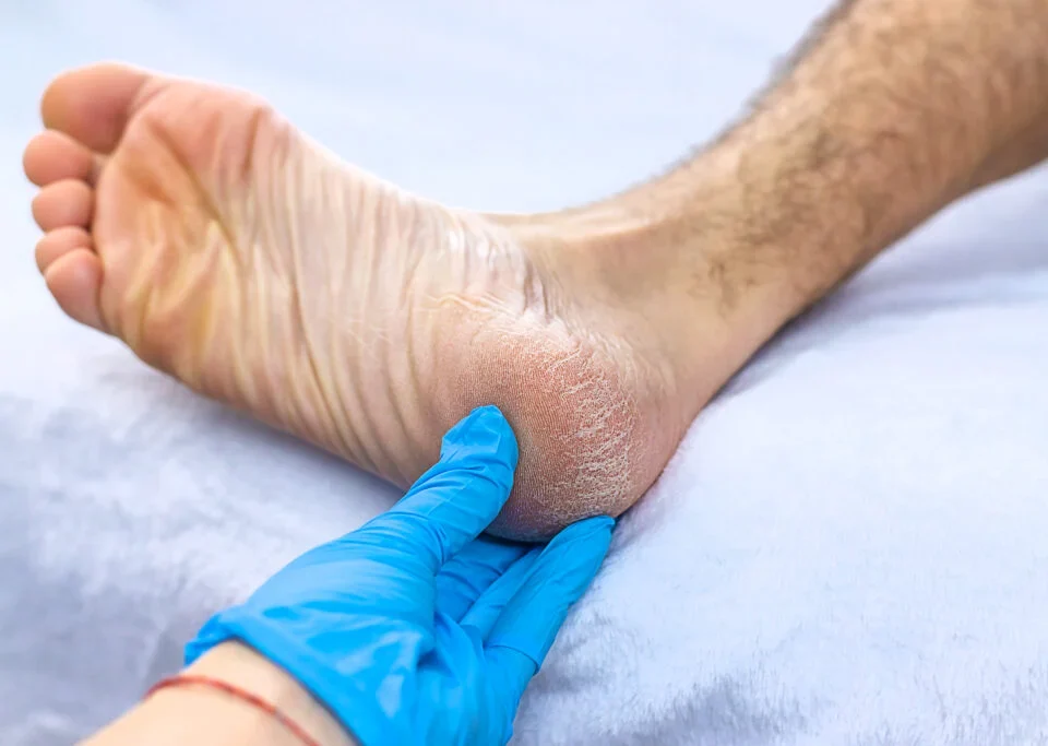 Understanding When to See a Podiatrist for Foot Pain