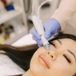 Understanding the Microneedling Process at a Wellness Center