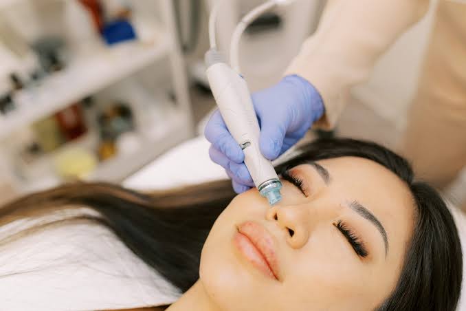 Understanding the Microneedling Process at a Wellness Center