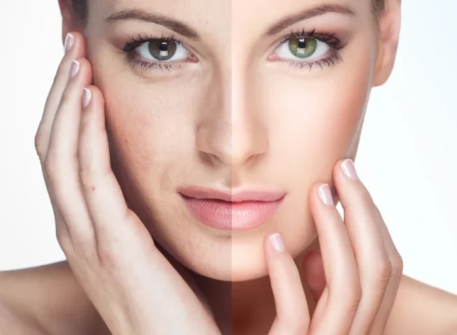 Exploring the Different Types of Laser Treatments for Skin Rejuvenation