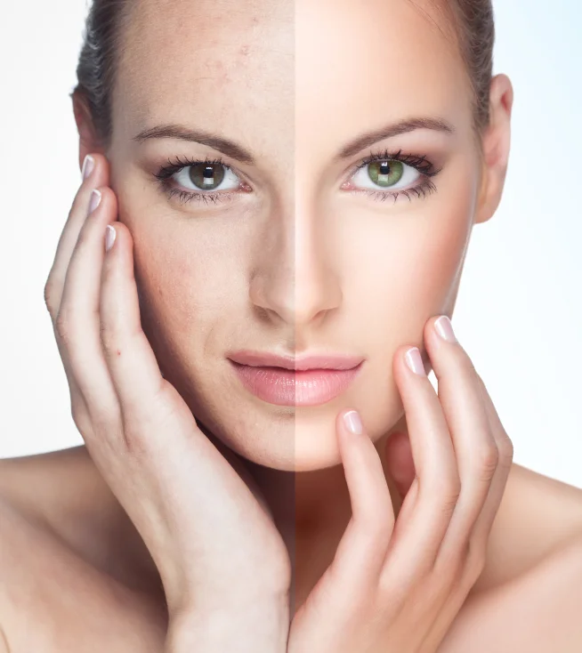 Exploring the Different Types of Laser Treatments for Skin Rejuvenation