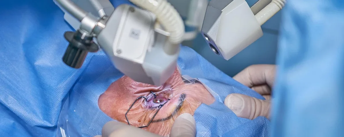 Understanding the Benefits and Risks of Cataract Surgery